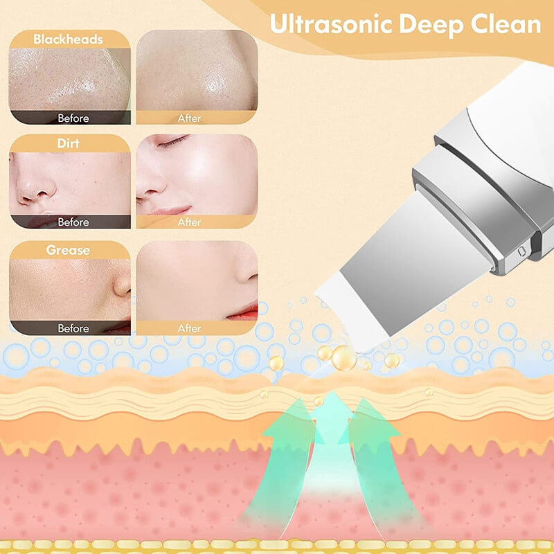 PuriGlow™ - Ultrasonic Skin Scrubber